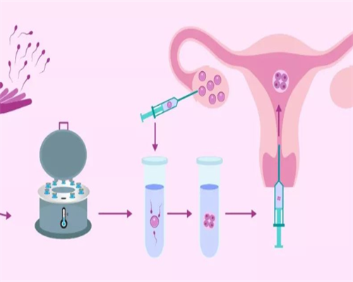 孕早期中期晚期怎么分