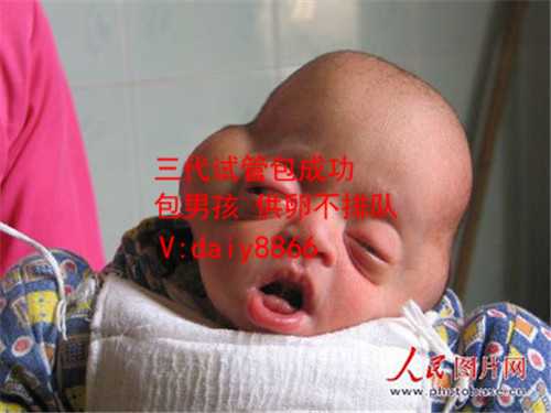 试管婴儿成功率龙凤胎_试管可以选男女嘛_广州医院浅析：子宫内膜炎的危害有