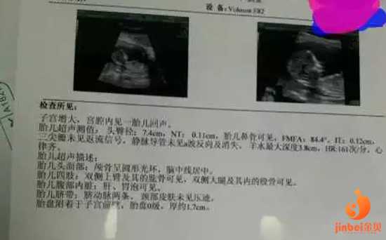 青岛借卵生育要多少钱_青岛借卵子生子最大年龄_山东济南哪家医院能做试管婴