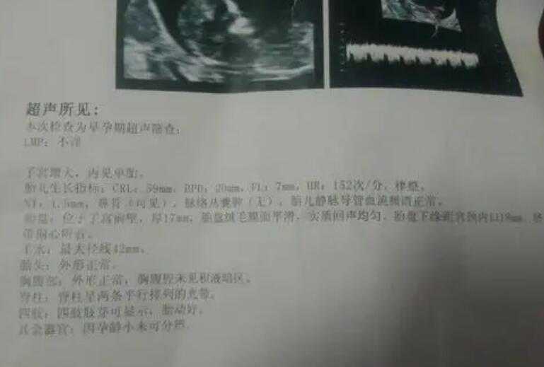 上海第一妇婴保健院试管养囊多少钱一个？_Mol5j