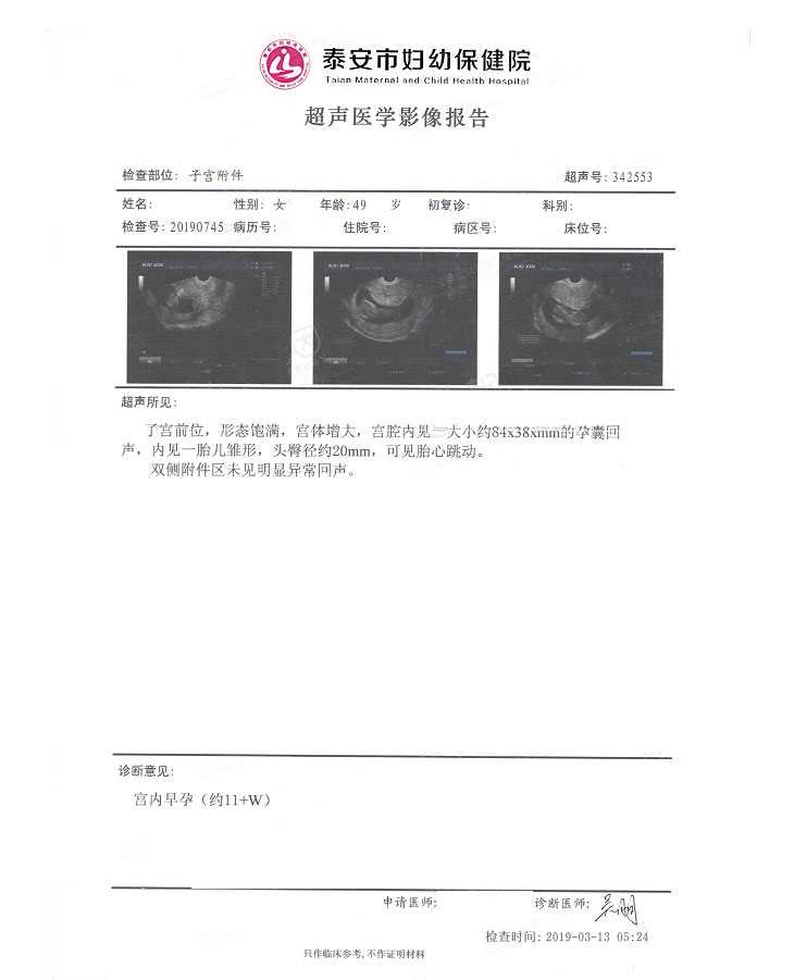 广州精因宝贝庄总电话[供卵自怀三胎]+一年没来月经了，49岁做试管婴儿成功的